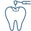 Dental Fillings