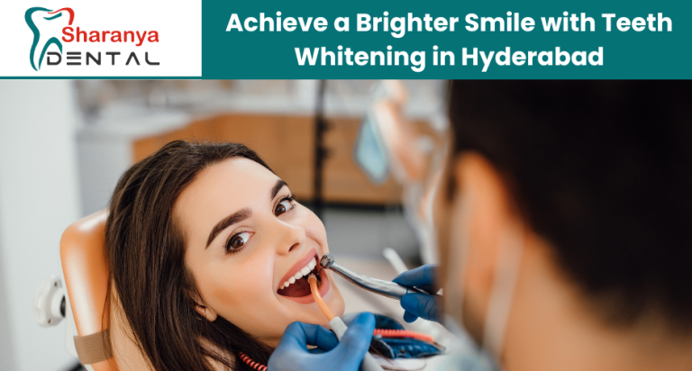 Laser Teeth Whitening in Hyderabad: How It Works and Why It’s Popular – Sharanya Dental